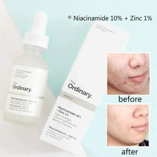 THE ORDINARY Niacinamide 10% + Zinc 1% 30ml